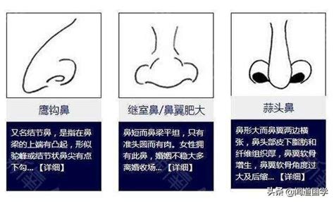 鼻孔大面相|鼻相分析10款｜鼻樑有節及橫紋、豬膽鼻、鼻頭下垂代 